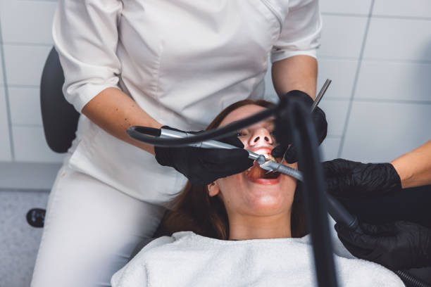 Best Emergency Wisdom Teeth Removal in Buckhead, GA